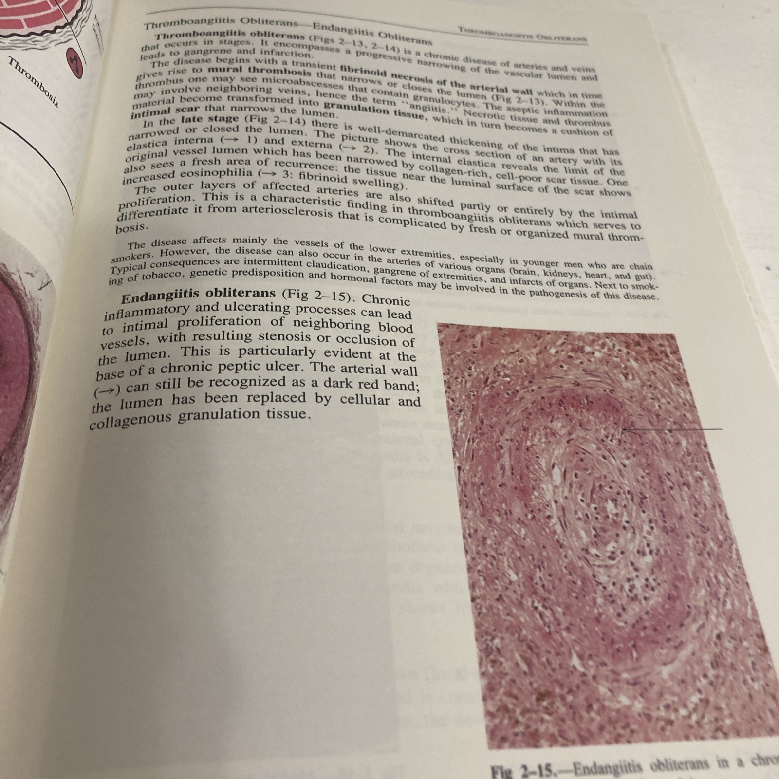 Sandritter&rsquo;s Color Atlas and Textbook of Histopathology by Carlos Thomas 7th Ed