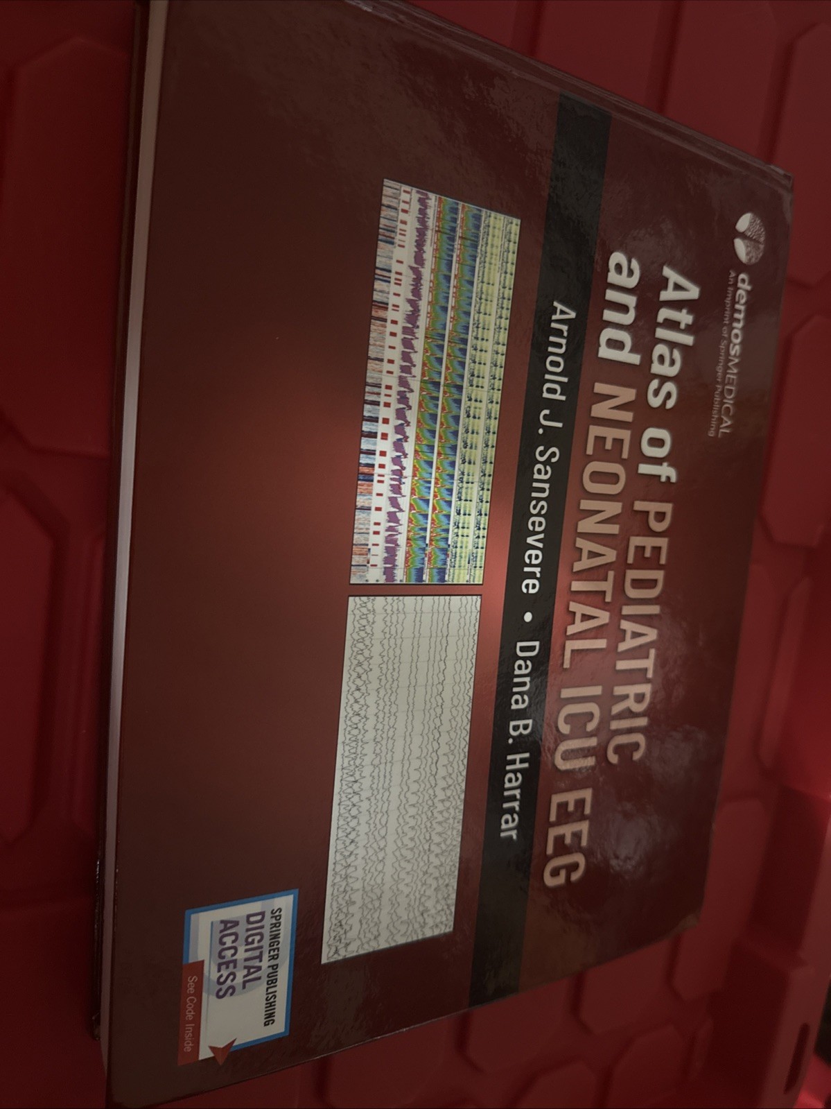 Atlas of Pediatric and Neonatal ICU EEG by Arnold J. ; Harrar Sansevere…