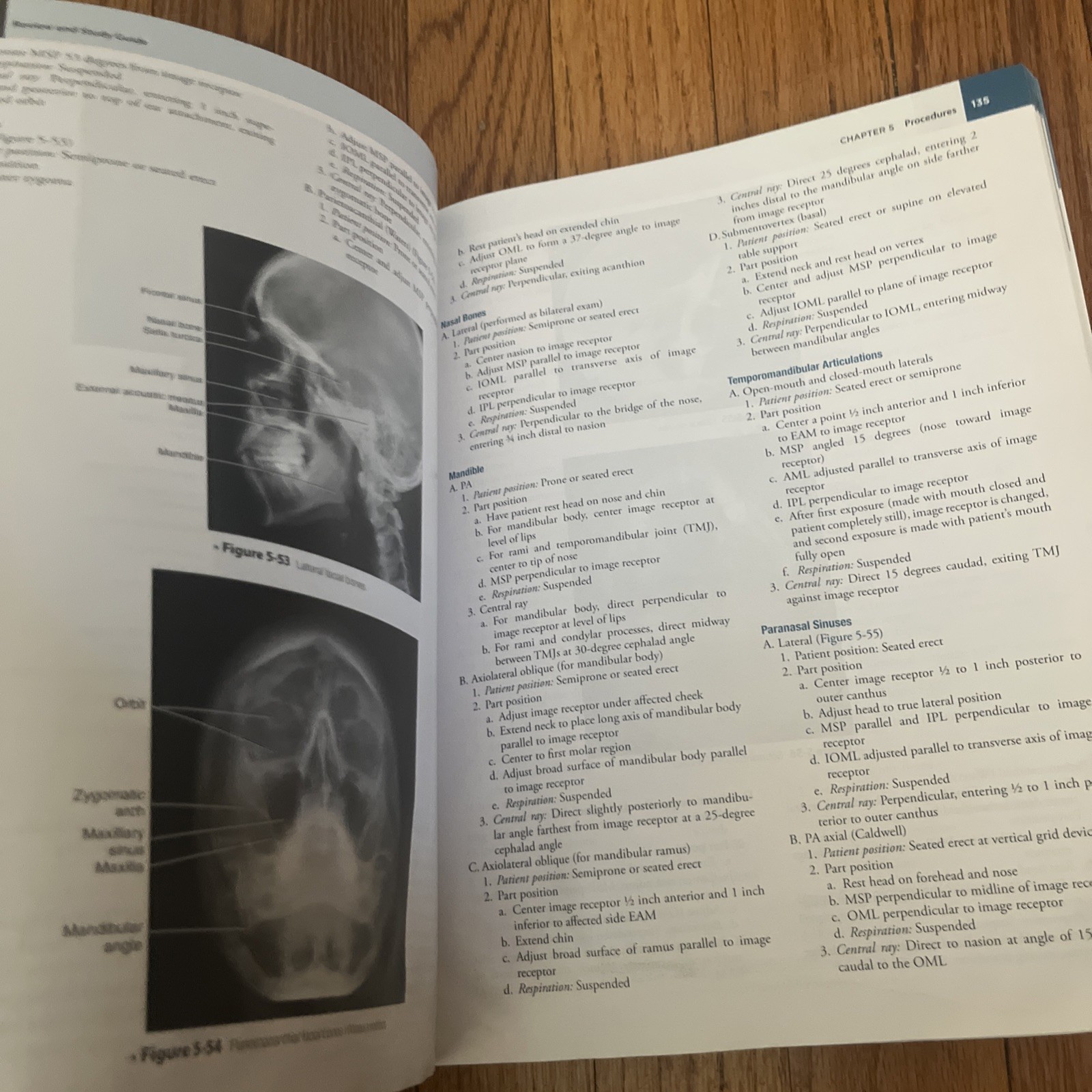 Mosby&rsquo;s Comprehensive Review of Radiography: The Complete Study Guide 8th Ed.