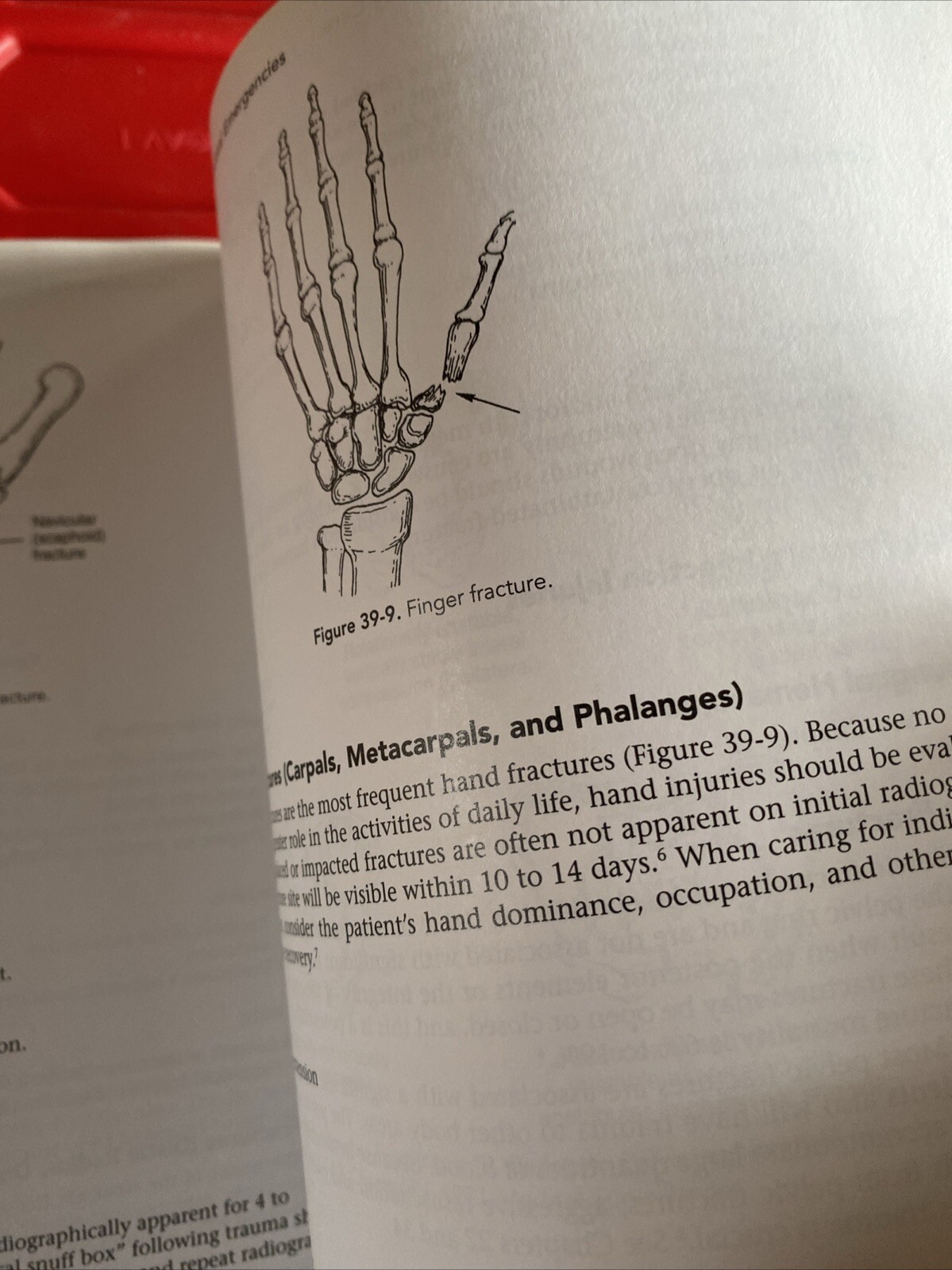 Sheehy&rsquo;s Manual of Emergency Care by Emergency Nurses Association Staff…