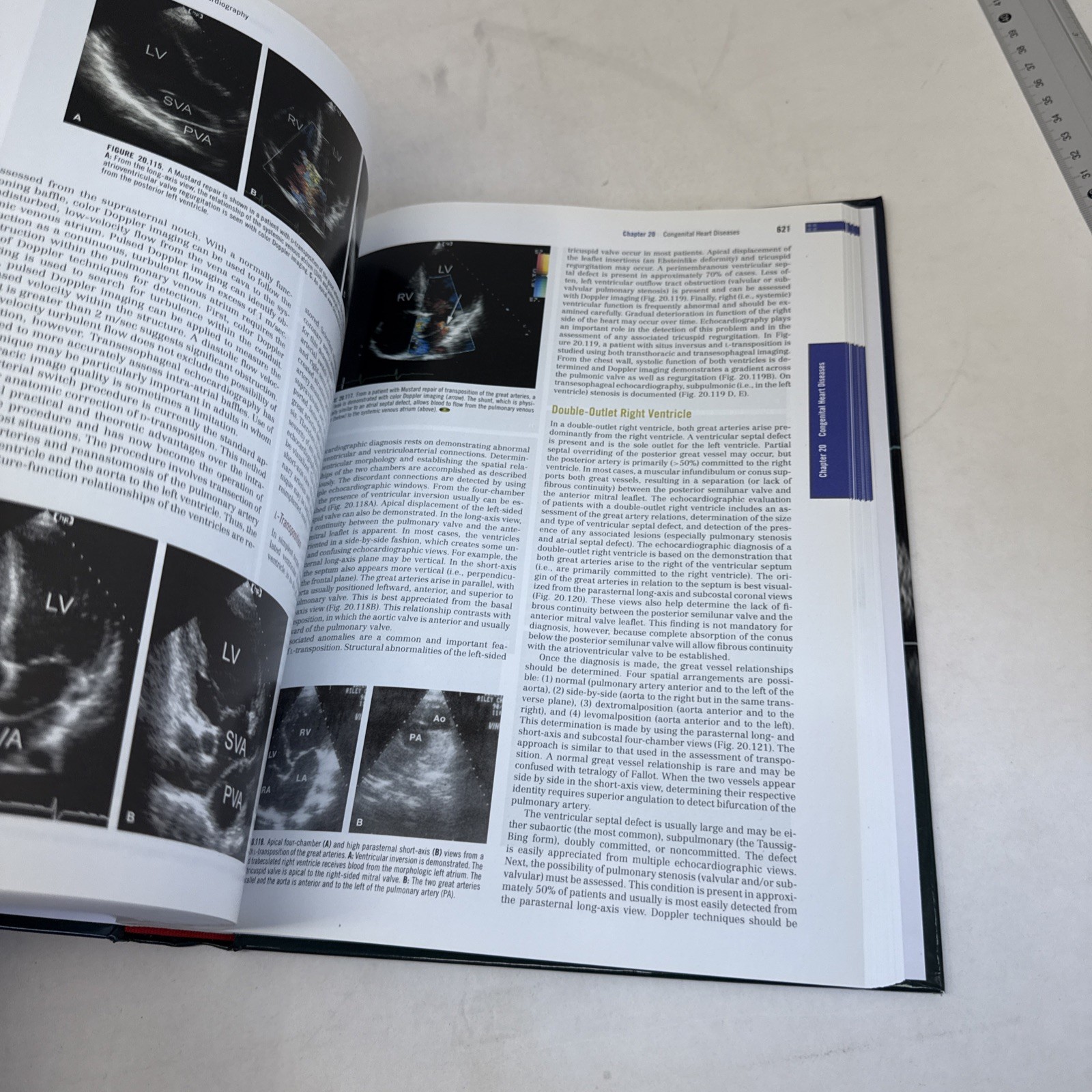 Feigenbaum&rsquo;s Echocardiography by Thomas Ryan and William F. Armstrong (2009,…