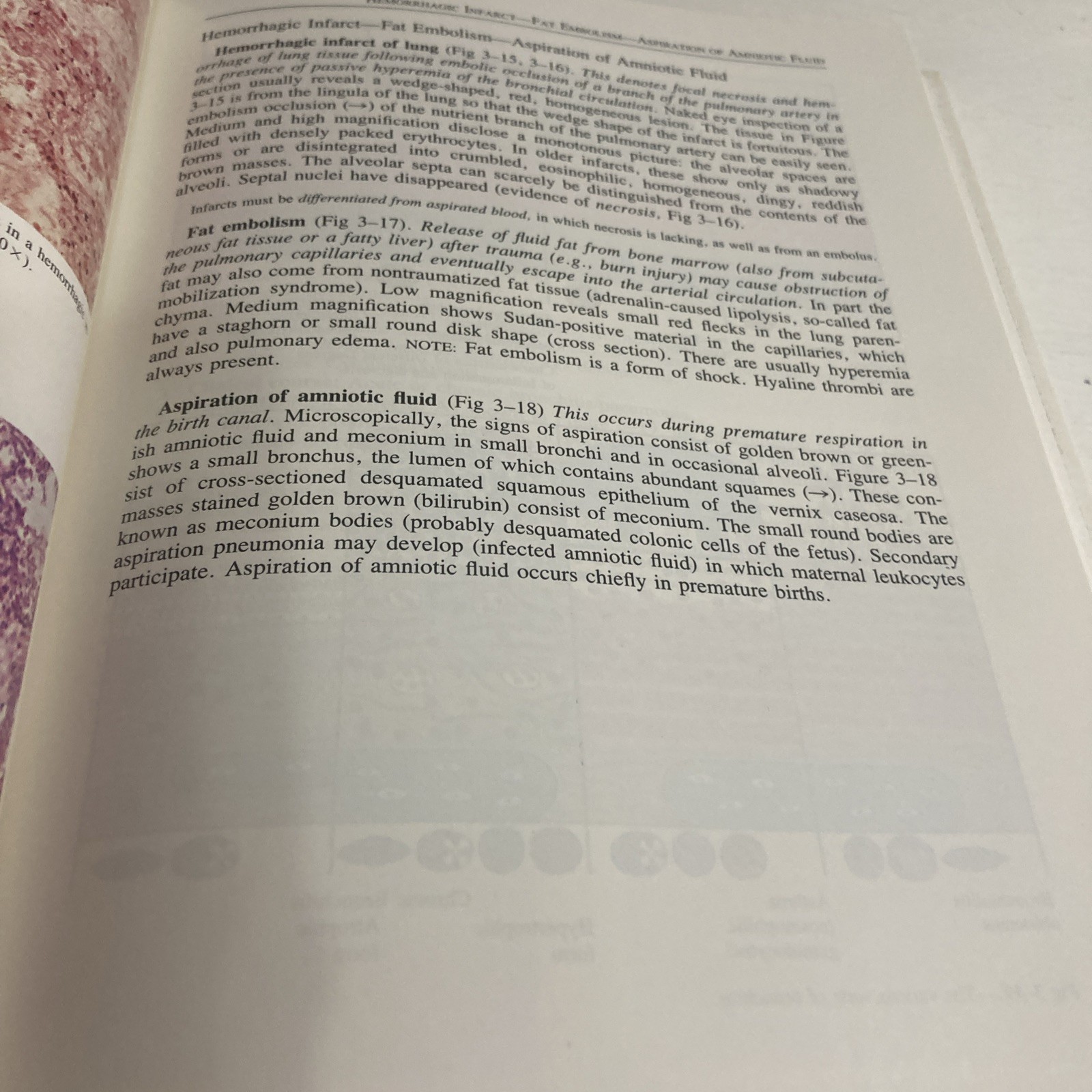 Sandritter&rsquo;s Color Atlas and Textbook of Histopathology by Carlos Thomas 7th Ed