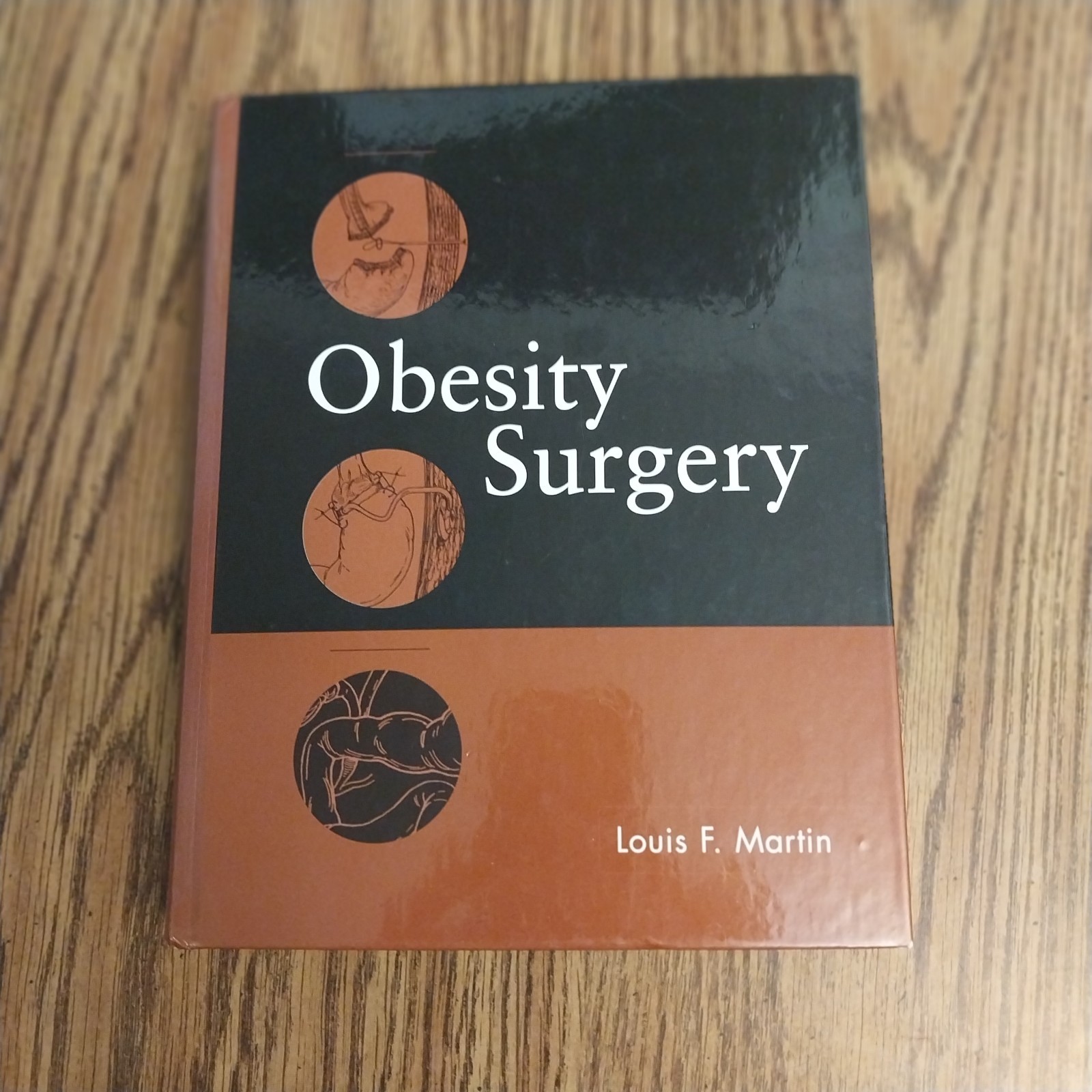 Obesity Surgery Louis F. Martin Hardcover 2004