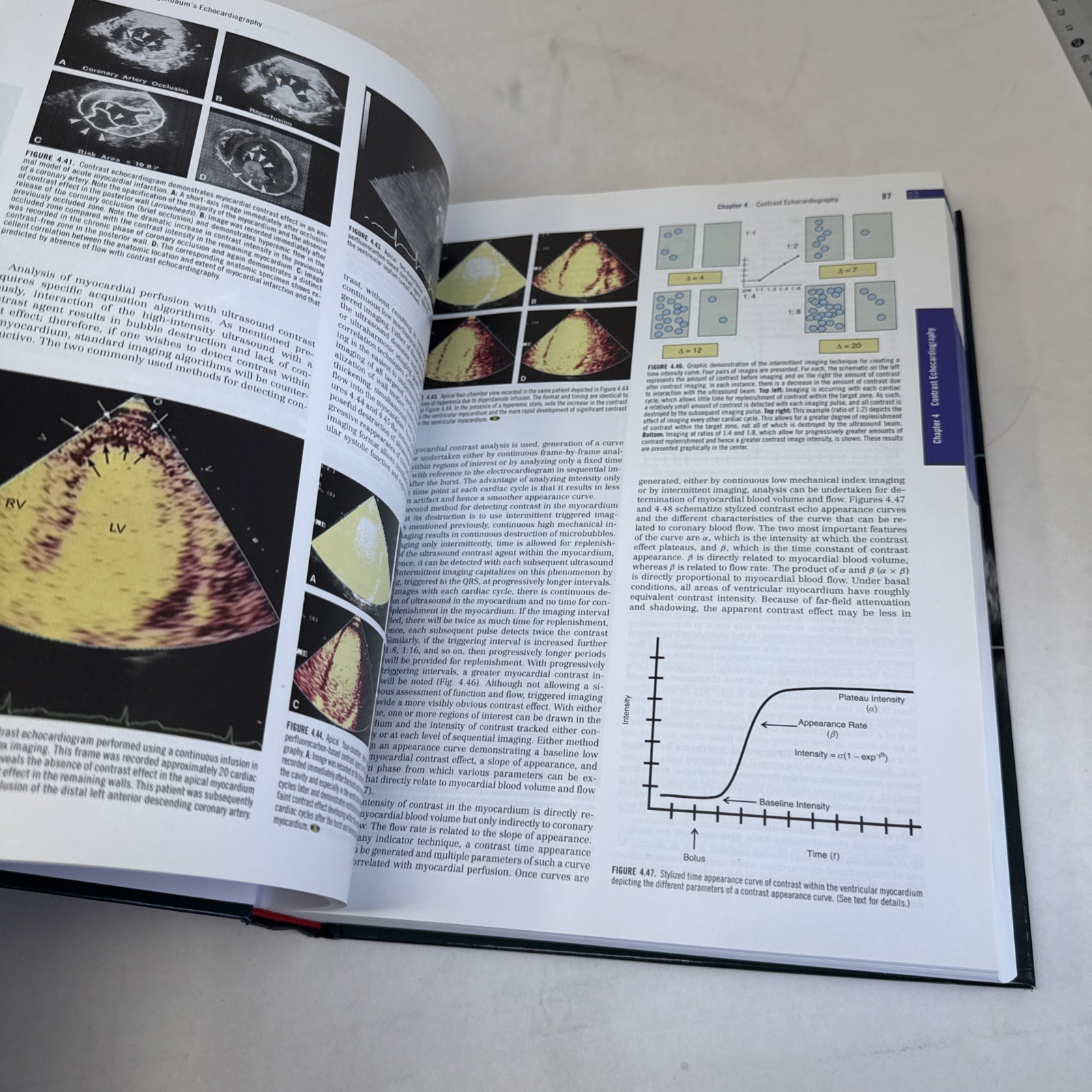 Feigenbaum&rsquo;s Echocardiography by Thomas Ryan and William F. Armstrong (2009,…