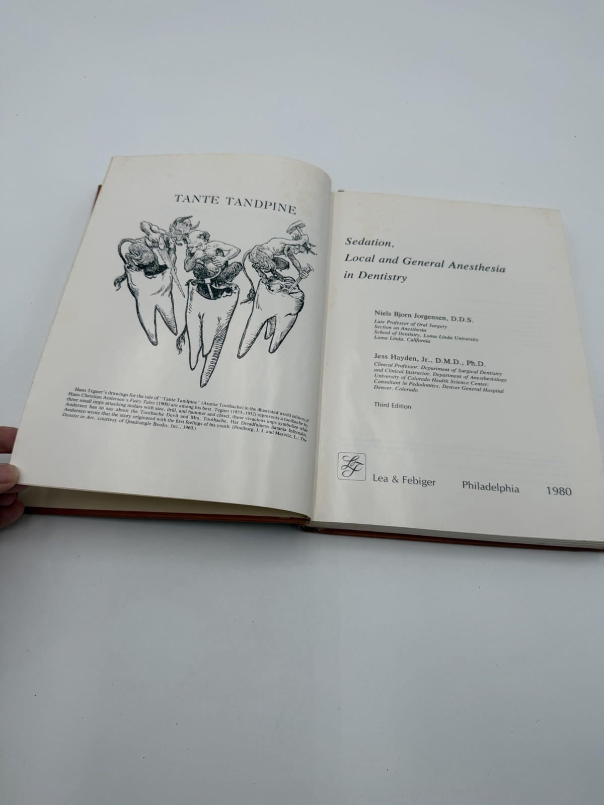 Sedation Local & General Anesthesia In Dentistry 3rd Ed Dental Textbook 1980