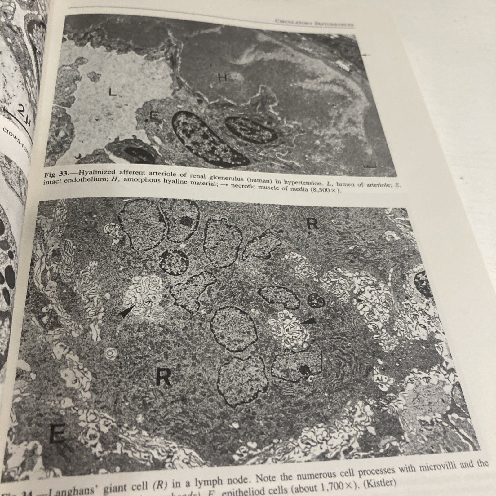 Sandritter&rsquo;s Color Atlas and Textbook of Histopathology by Carlos Thomas 7th Ed