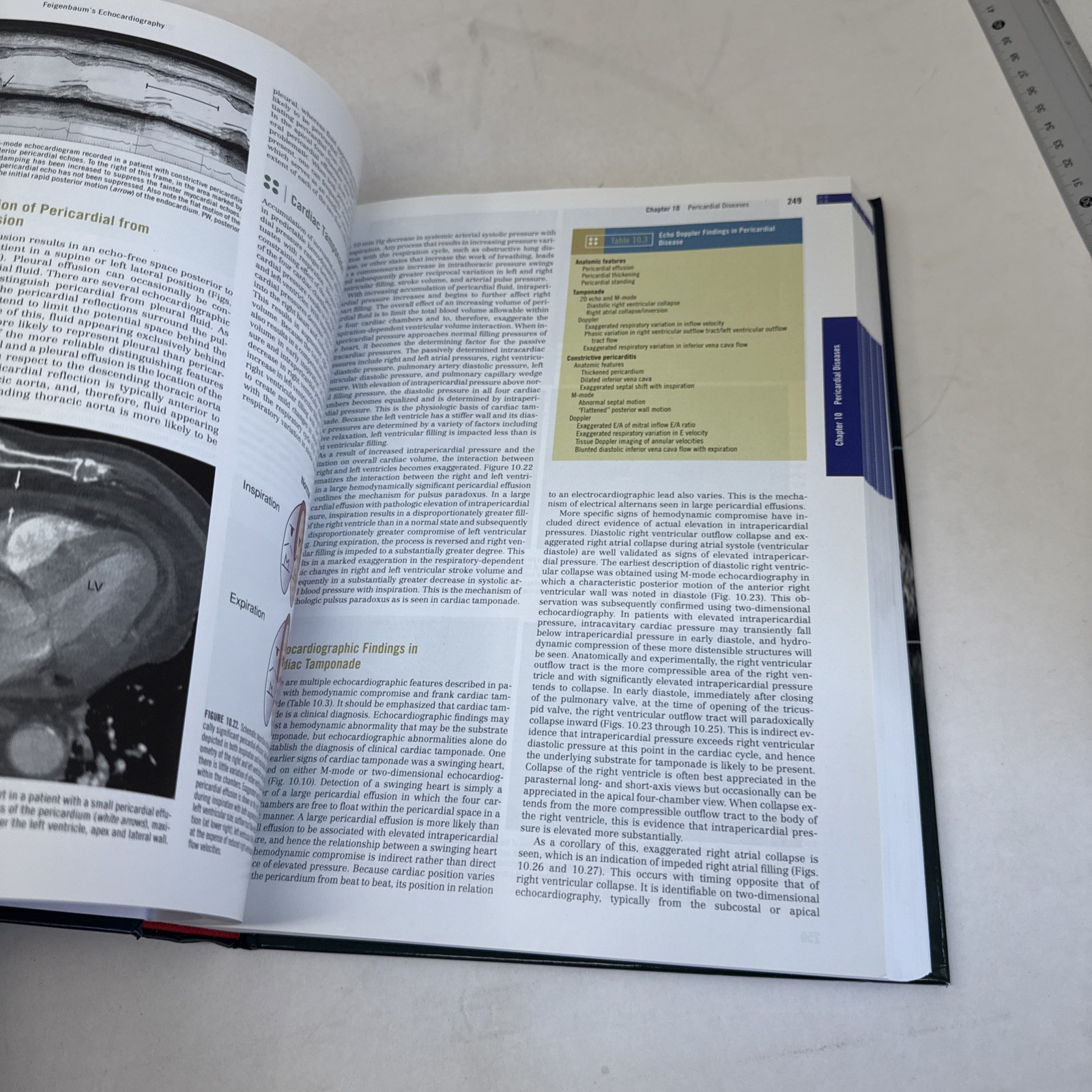 Feigenbaum&rsquo;s Echocardiography by Thomas Ryan and William F. Armstrong (2009,…